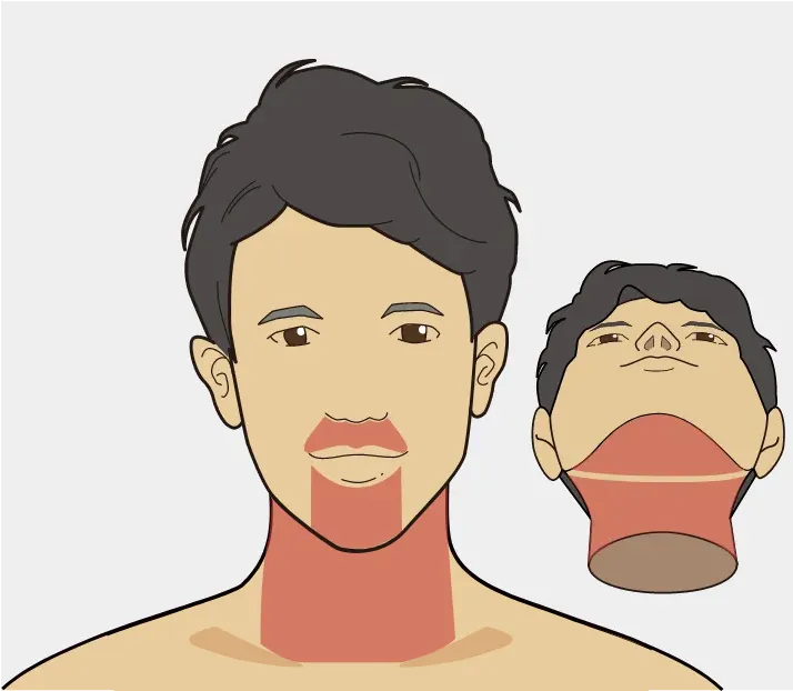 ヒゲ脱毛４部位　アイキャッチ画像