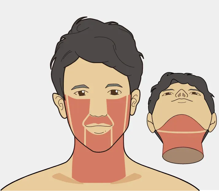 ヒゲ脱毛６部位　アイキャッチ画像