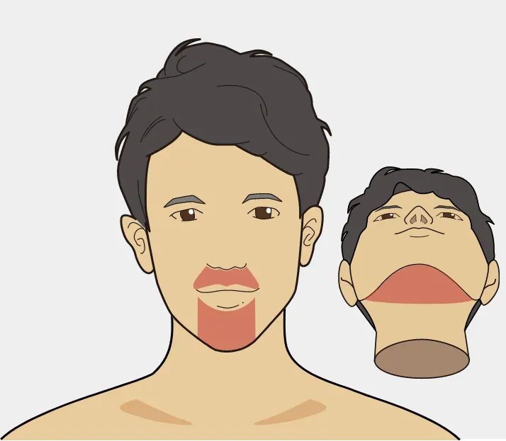 ヒゲ脱毛３部位　アイキャッチ画像